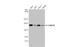 FANCD2 Antibody in Western Blot (WB)