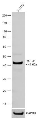 RAD52 Antibody in Western Blot (WB)