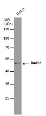 RAD52 Antibody in Western Blot (WB)