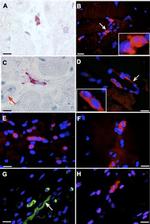 Tyrosine Hydroxylase Antibody in Immunohistochemistry (IHC)