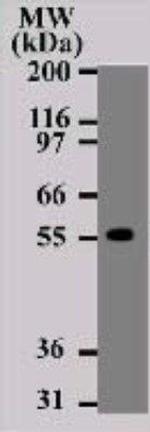 DR4 Antibody in Western Blot (WB)