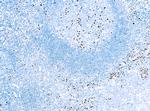 IRF4 Antibody in Immunohistochemistry (Paraffin) (IHC (P))