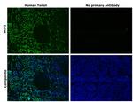 Bcl-2 Antibody in Immunohistochemistry (Paraffin) (IHC (P))