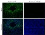 Bcl-2 Antibody in Immunohistochemistry (Paraffin) (IHC (P))