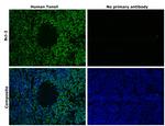 Bcl-2 Antibody in Immunohistochemistry (Paraffin) (IHC (P))