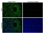 Bcl-2 Antibody in Immunohistochemistry (Paraffin) (IHC (P))