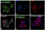 Cytokeratin Pan Antibody in Immunocytochemistry (ICC/IF)