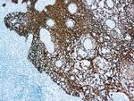 Cytokeratin Pan Antibody in Immunohistochemistry (Paraffin) (IHC (P))