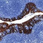 Cytokeratin Pan Antibody in Immunohistochemistry (Paraffin) (IHC (P))