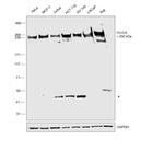 POLR2A Antibody in Western Blot (WB)