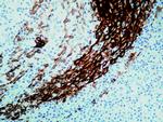 Cytokeratin Pan Type I Antibody in Immunohistochemistry (Paraffin) (IHC (P))