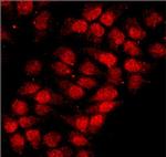 hnRNP A1 Antibody in Immunocytochemistry (ICC/IF)