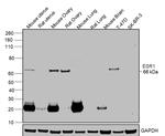 Estrogen Receptor alpha Antibody