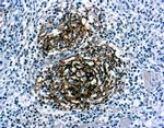 CD21 Antibody in Immunohistochemistry (Paraffin) (IHC (P))