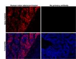 beta Catenin Antibody in Immunohistochemistry (Paraffin) (IHC (P))