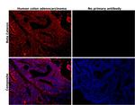 beta Catenin Antibody in Immunohistochemistry (Paraffin) (IHC (P))