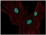 p21 Antibody in Immunocytochemistry (ICC/IF)