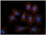 CSK Antibody in Immunocytochemistry (ICC/IF)