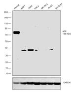 AFP Antibody in Western Blot (WB)