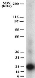 CD254 (RANK Ligand) Antibody in Western Blot (WB)