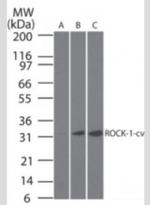 ROCK1 (Cleaved Asp1113) Antibody in Western Blot (WB)