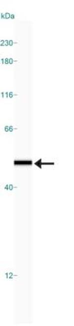 IKK gamma Antibody in Western Blot (WB)