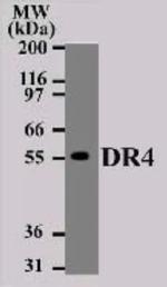 DR4 Antibody in Western Blot (WB)