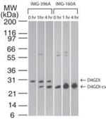 D4-GDI Antibody in Western Blot (WB)