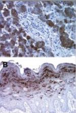 Bi-1 Antibody in Immunohistochemistry (Paraffin) (IHC (P))