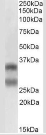 CD254 (RANK Ligand) Antibody in Western Blot (WB)