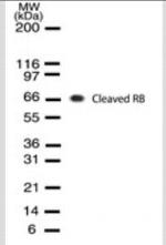 Rb (Cleaved DRb-p70) Antibody in Western Blot (WB)