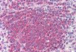 CHK2 Antibody in Immunohistochemistry (Paraffin) (IHC (P))