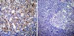 Phospho-Progesterone Receptor (Ser190) Antibody in Immunohistochemistry (Paraffin) (IHC (P))