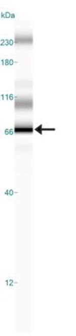 WT1 Antibody in Western Blot (WB)