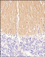 CD171 Antibody in Immunohistochemistry (Paraffin) (IHC (P))