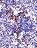 Phospho-ATM (Ser1981) Antibody in Immunohistochemistry (Paraffin) (IHC (P))