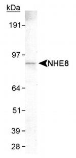 SLC9A8 Antibody in Western Blot (WB)