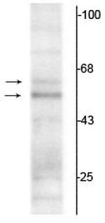 THRA Antibody in Western Blot (WB)