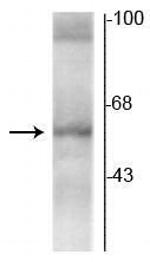 THRA Antibody in Western Blot (WB)