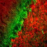 alpha Internexin Antibody in Immunohistochemistry (IHC)