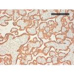 Cytokeratin Pan Type I Antibody in Immunohistochemistry (Paraffin) (IHC (P))