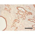 Cytokeratin Pan Type I Antibody in Immunohistochemistry (Paraffin) (IHC (P))