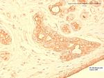 Cytokeratin Pan Type II Antibody in Immunohistochemistry (Paraffin) (IHC (P))