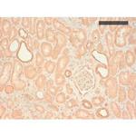 Cytokeratin Pan Type II Antibody in Immunohistochemistry (Paraffin) (IHC (P))