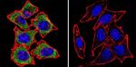 NR3C2 Antibody in Immunocytochemistry (ICC/IF)