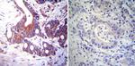 NR3C2 Antibody in Immunohistochemistry (Paraffin) (IHC (P))