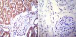 NR3C2 Antibody in Immunohistochemistry (Paraffin) (IHC (P))