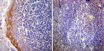 NR3C2 Antibody in Immunohistochemistry (Paraffin) (IHC (P))