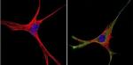 GRK1 Antibody in Immunocytochemistry (ICC/IF)