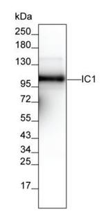 C1 inhibitor Antibody in Western Blot (WB)